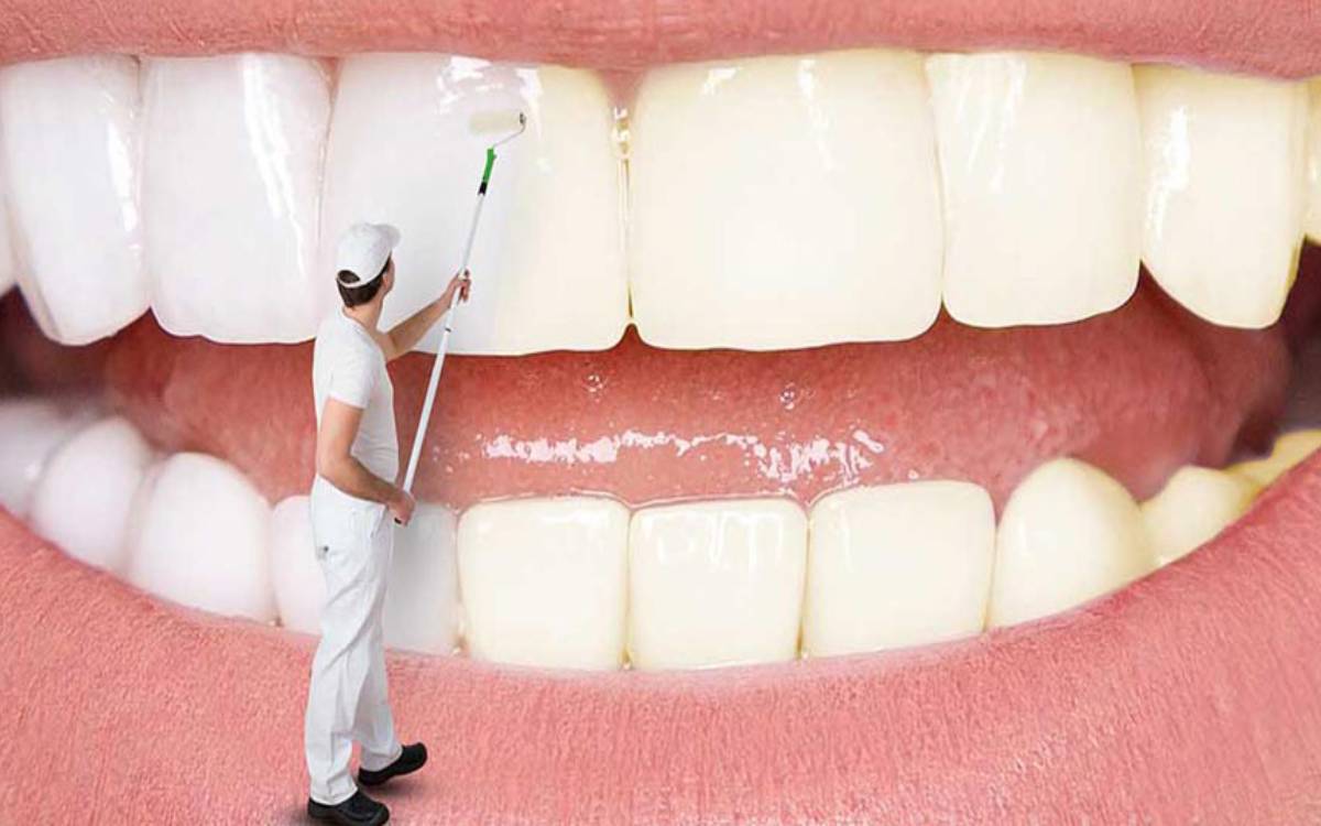 سفید کردن دندان های زرد شده