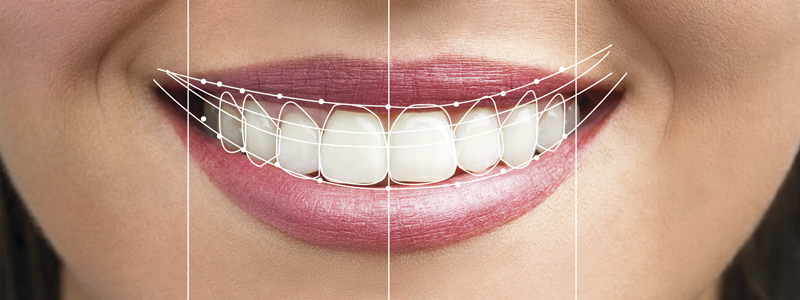 ترمیم دندان ها برای داشتن بهترین طرح لبخند